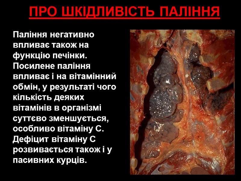 Паління негативно впливає також на функцію печінки. Посилене паління впливає і на вітамінний обмін,